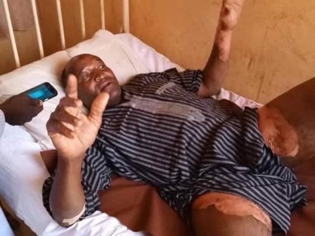 Photos of Kano teacher whose wife scalded his private part with hot water for planning to marry second wife