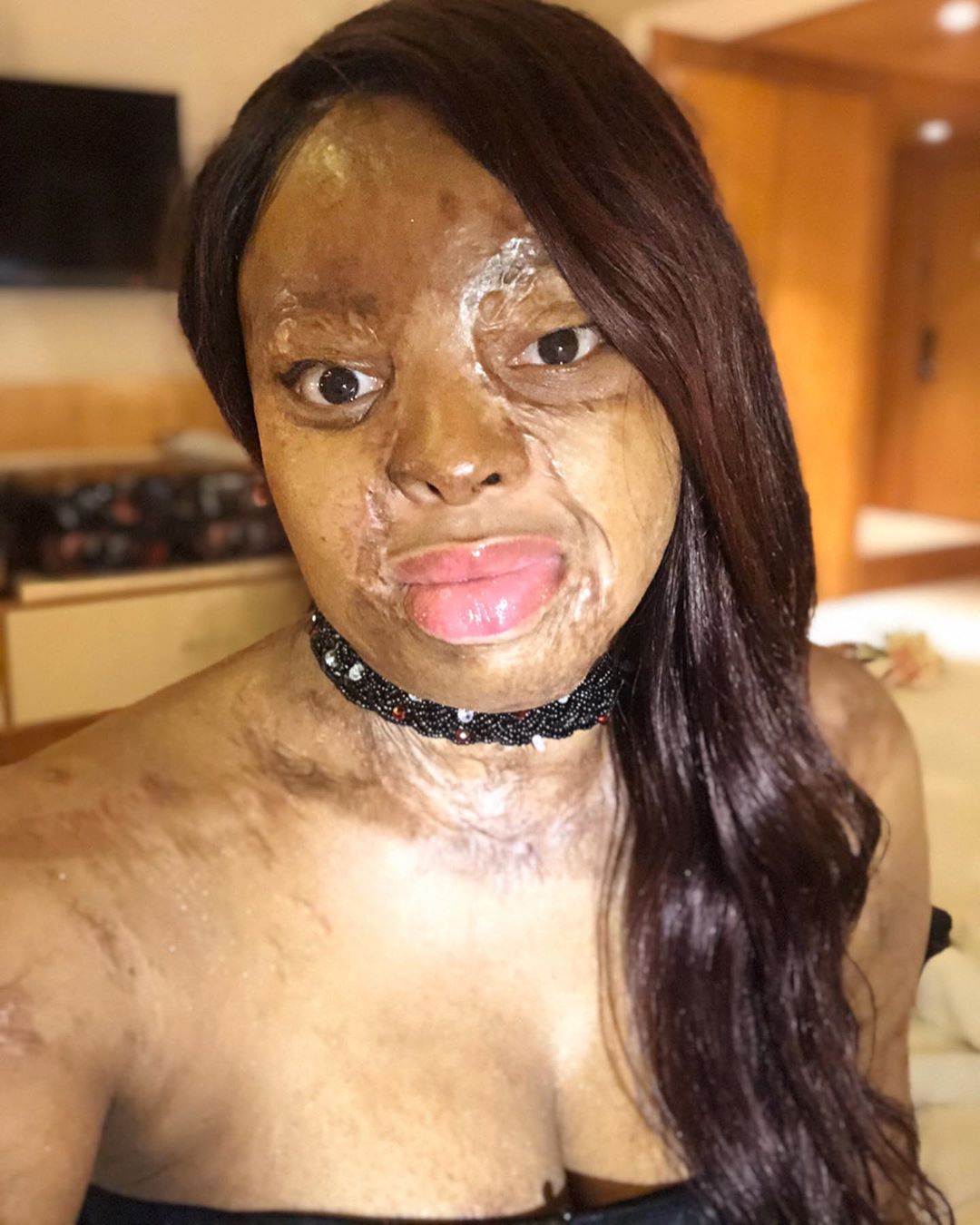 Plane Crash Survivor, Kechi Okwuchi celebrates as she turns 30 (photos)