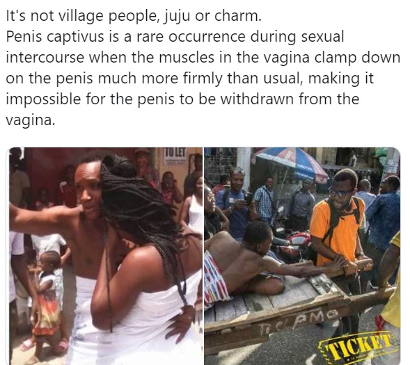 Magun does not exist, it is called P*nis Captivus – Nigerian Lady writes